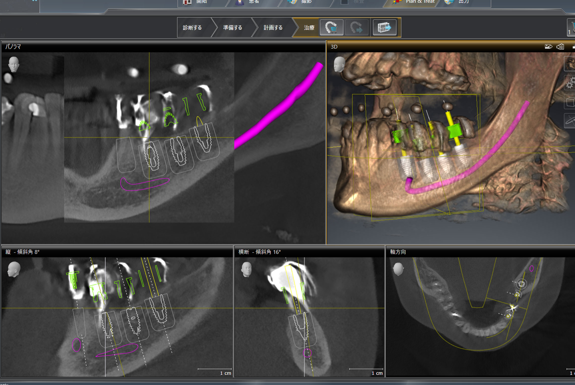 術前の精密計画が治療を決める。