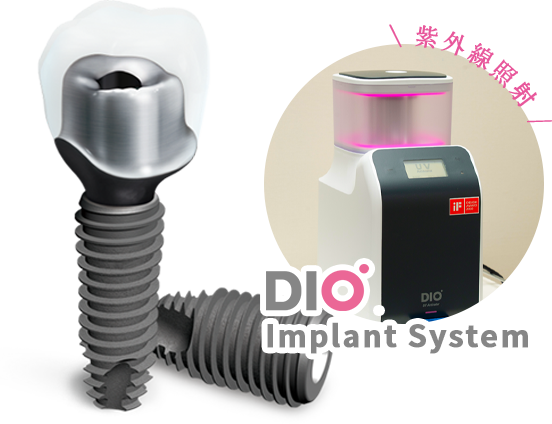 デジタル技術に特化 DIOインプラント