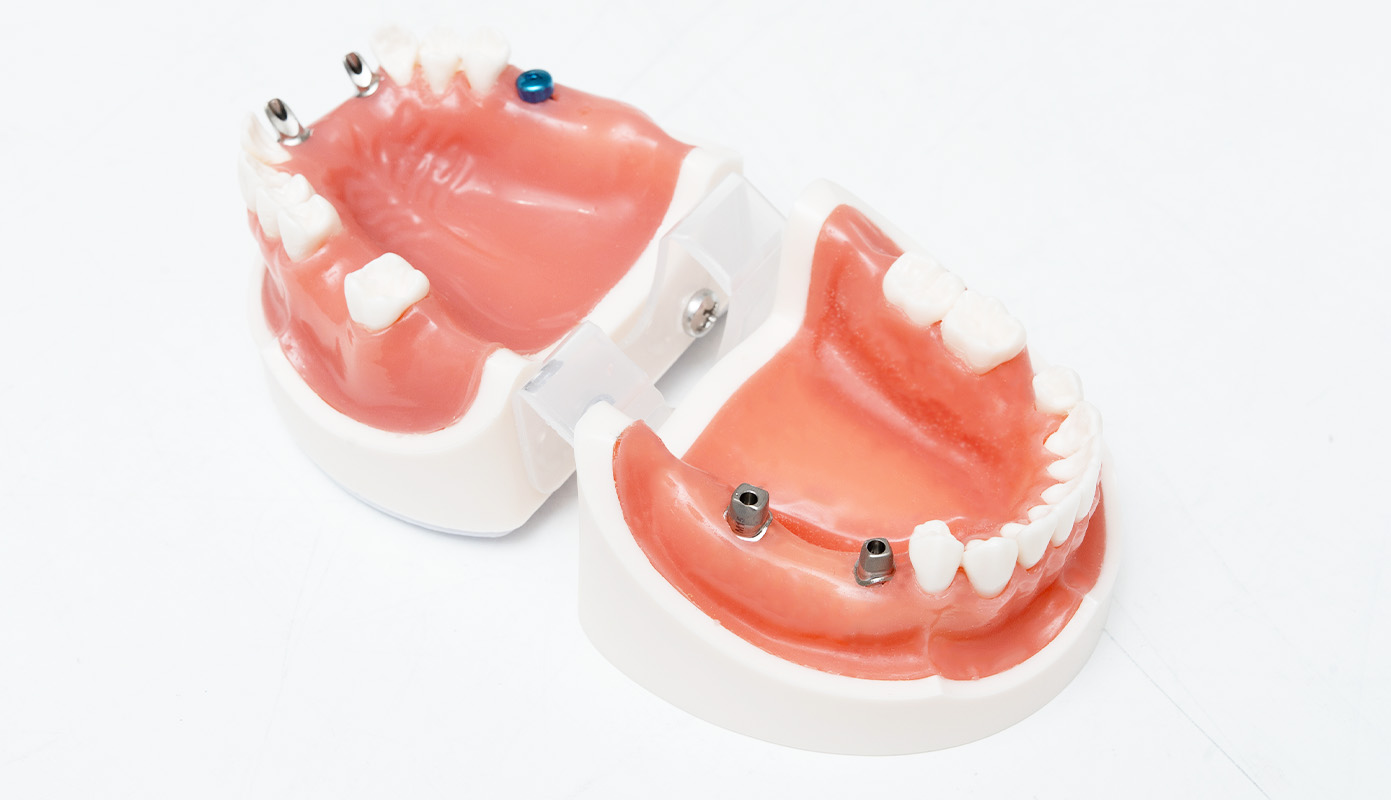納得して開始できるわかりやすい治療費